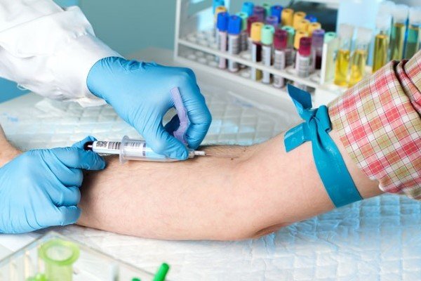 Как измеряют ПСА крови и какие показатели при аденоме простаты